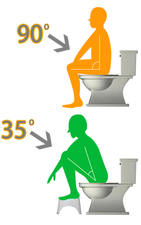 一張插圖展示了兩個不同的排便的坐姿，上方是一個橙色的人型剪影以90度的角度坐在馬桶，下方是一個綠色的人型剪影以35度的角度坐在馬桶。