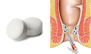 由兩張圖片組成，左邊是兩顆白色的藥丸，右邊是透視肛門圖，有一枝針筒刺進肛門。